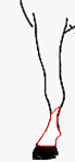 balzana
