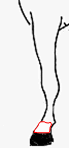 balzana
